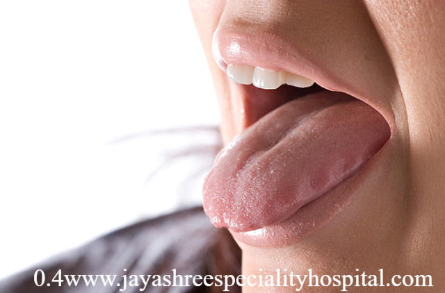 Penyebab Mulut Pahit dan Cara Mengatasinya