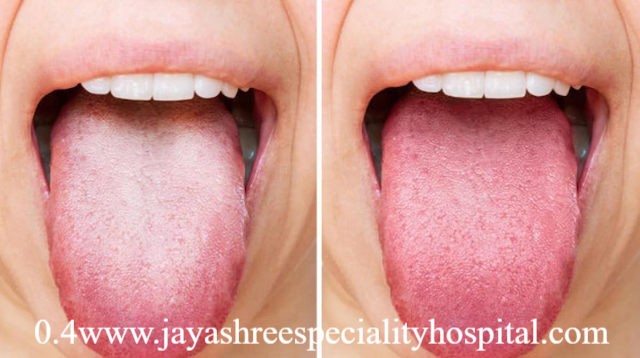 Warna Lidah Normal dan Tidak, Ini Bedanya