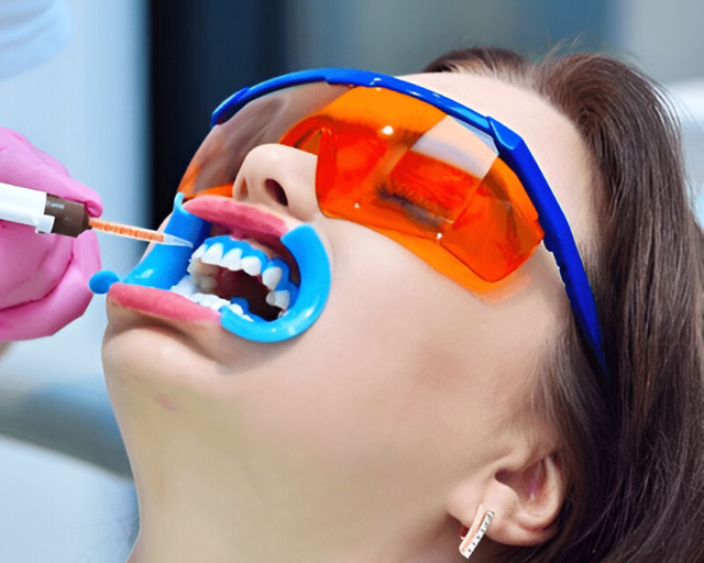 Berapa Lama Efek Memutihkan Gigi di Dokter Bisa Bertahan?